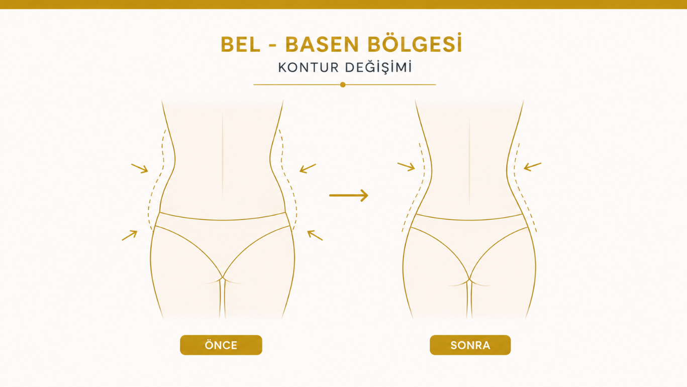 Bel ve basen liposuction