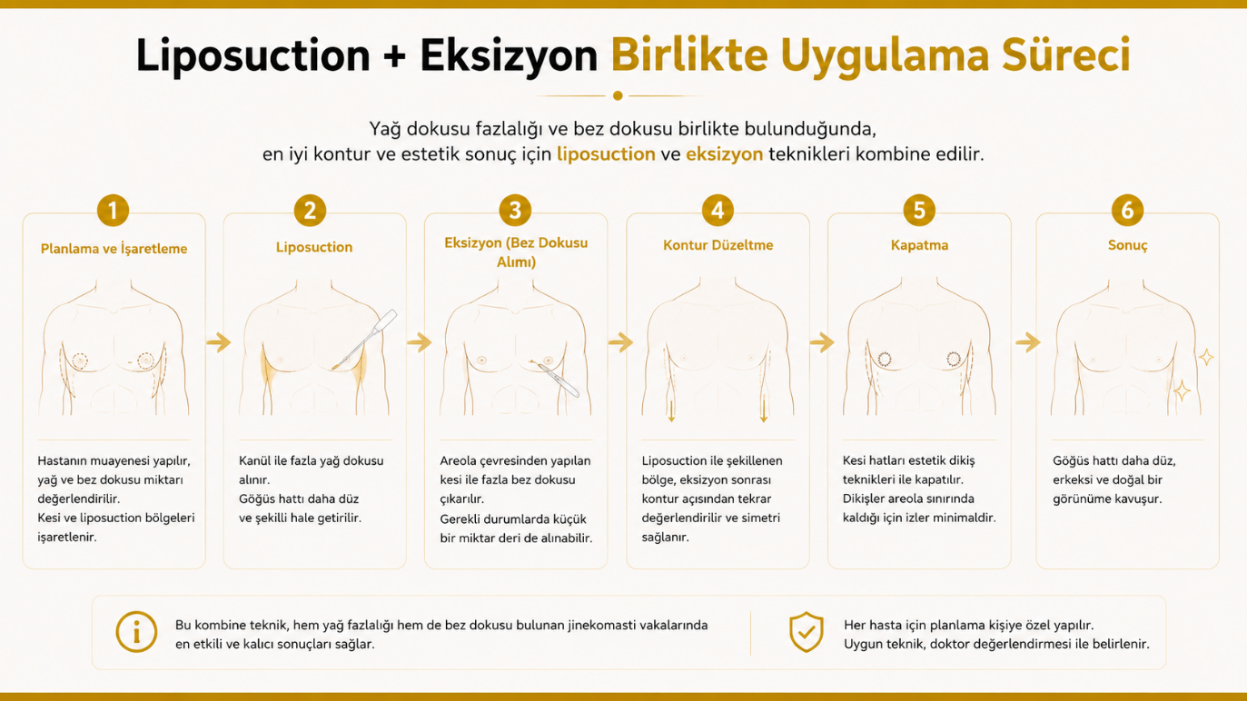 Kombine yöntemle jinekomasti ameliyatı