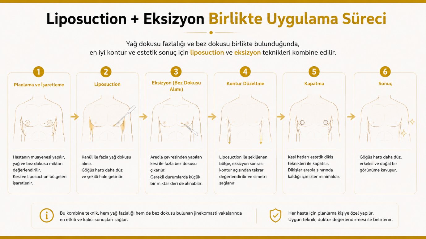 Kombine yöntemle jinekomasti ameliyatı