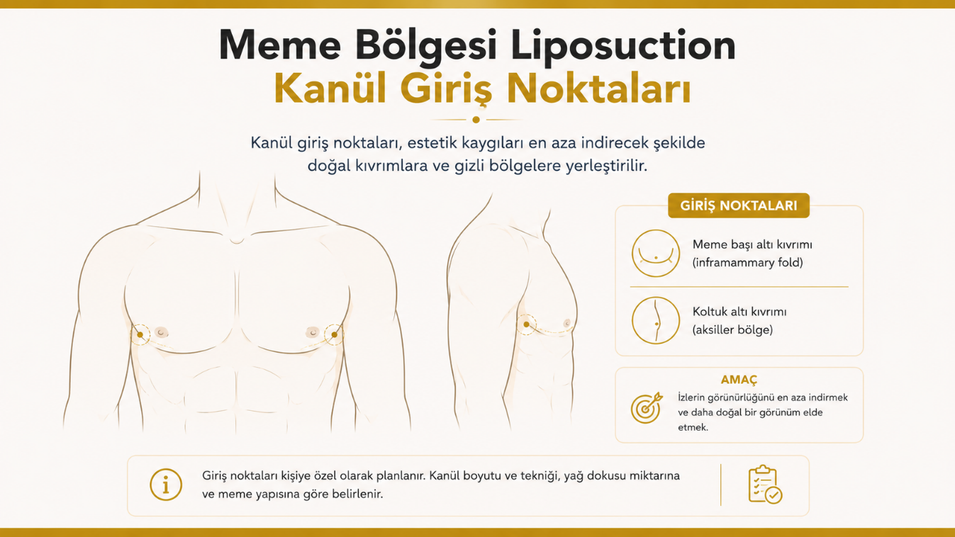 Liposuction yöntemiyle jinekomasti ameliyatı