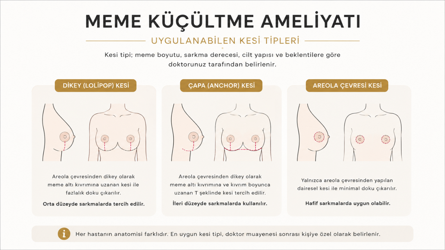 Meme küçültme ameliyatı