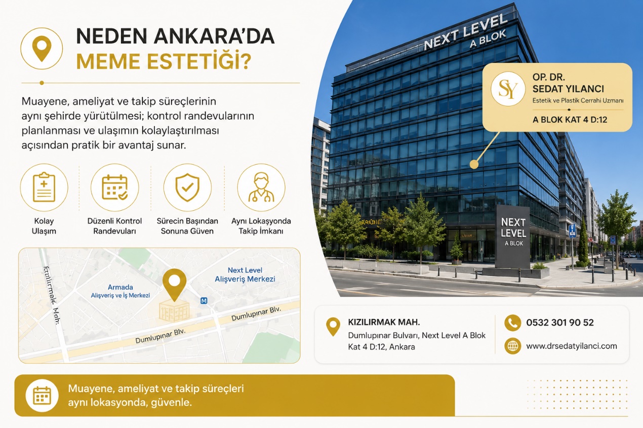 Neden Ankara'da meme estetiği